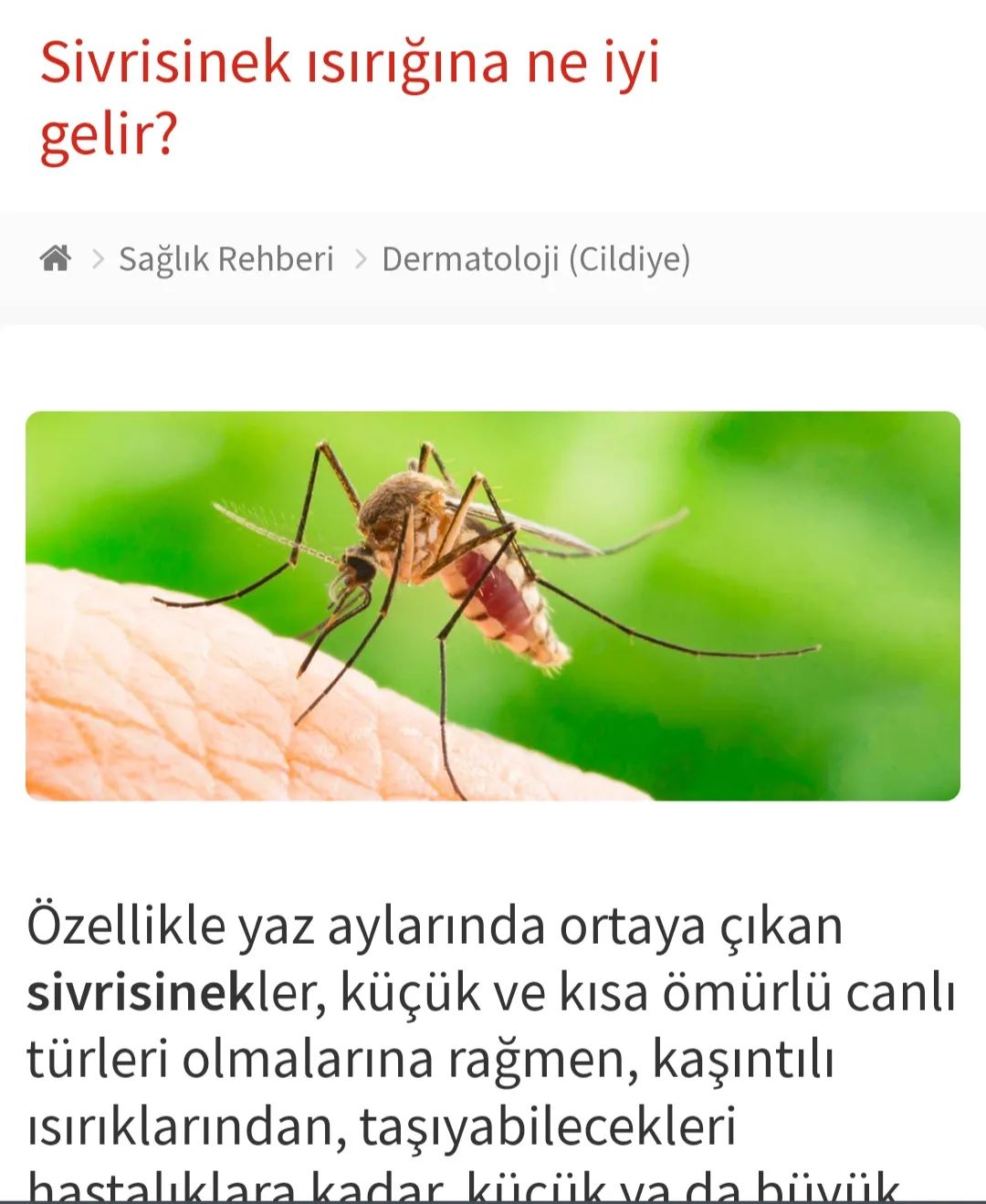 Sivri sinek ısırığına ne iyi gelir